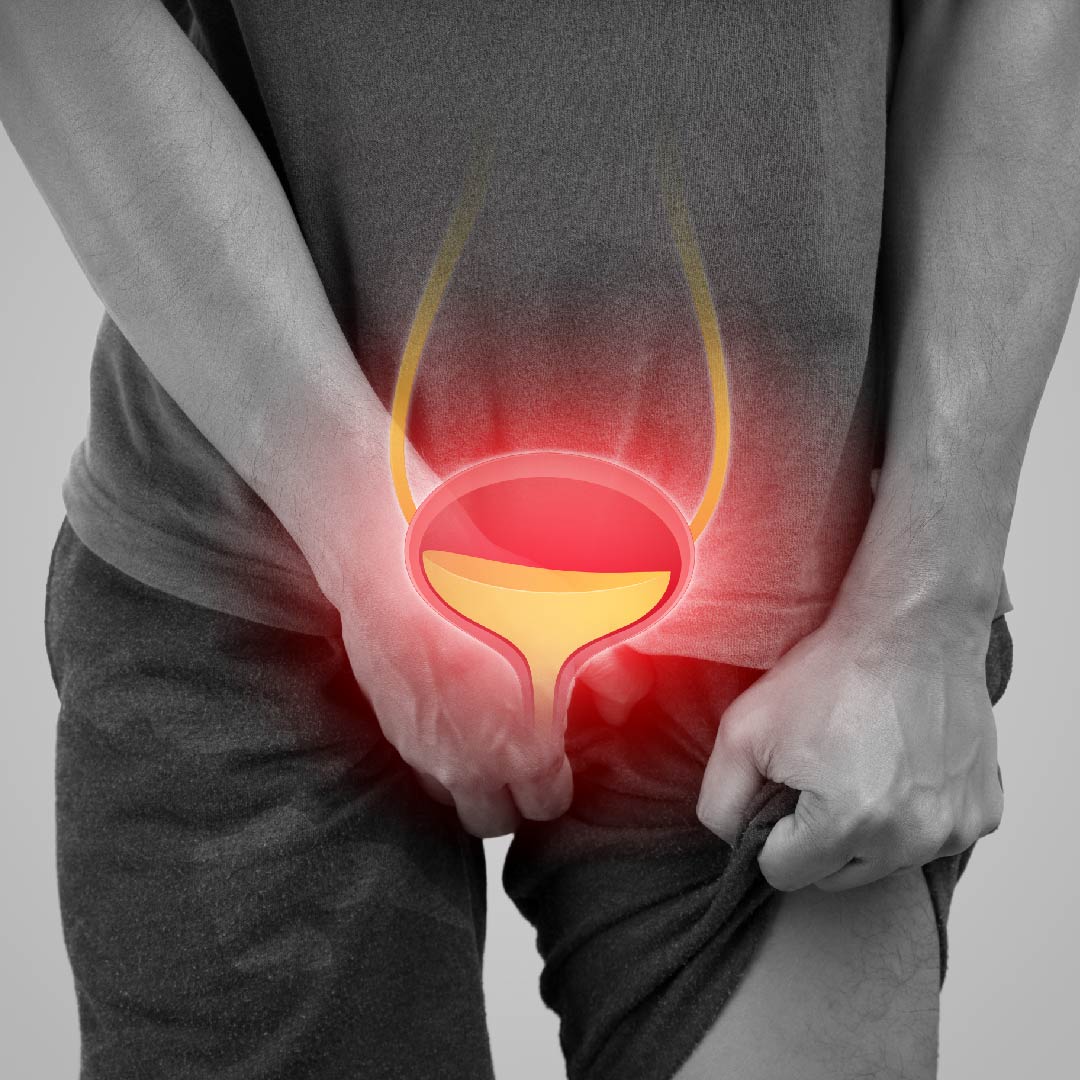 imagine pentru pagina tratamentul adenomului de prostata la clinica ro-boost